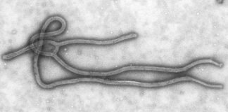 Virus Ebola filovirus